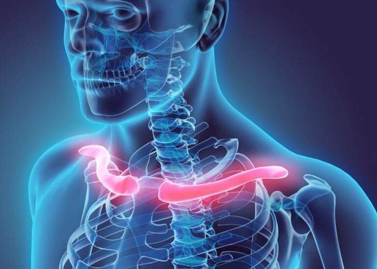 A graphic showing where the collarbones are on a skeleton.